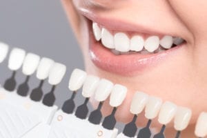 teeth whitening in garner nc