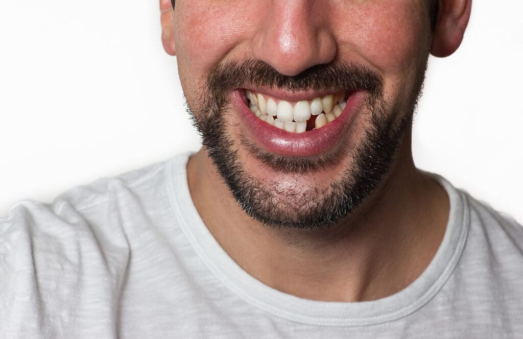 Missing Teeth Garner NC